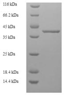 (Tris-Glycine gel) Discontinuous SDS-PAGE (reduced) with 5% enrichment gel and 15% separation gel.