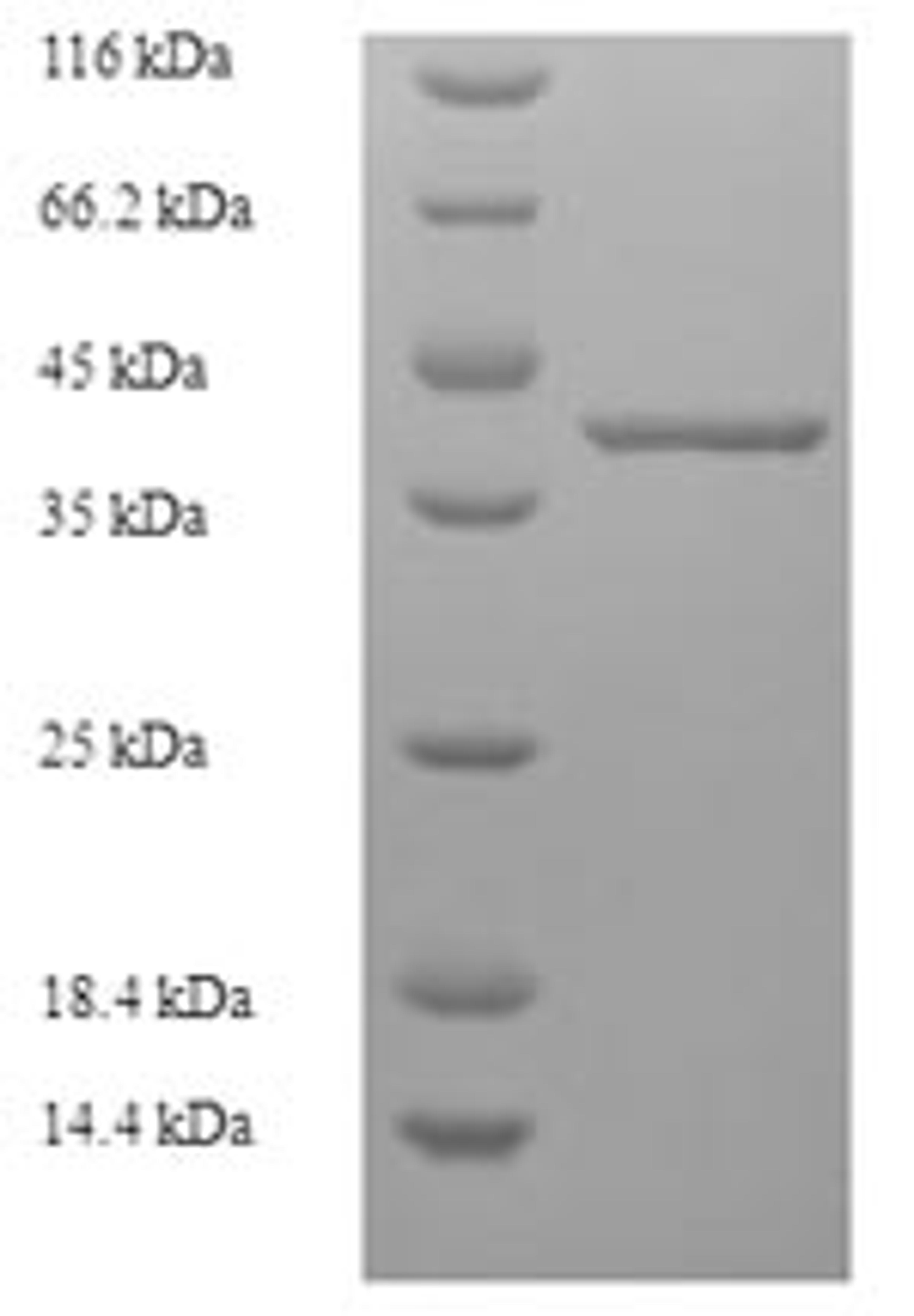 (Tris-Glycine gel) Discontinuous SDS-PAGE (reduced) with 5% enrichment gel and 15% separation gel.