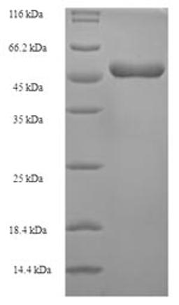 (Tris-Glycine gel) Discontinuous SDS-PAGE (reduced) with 5% enrichment gel and 15% separation gel.