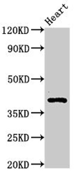 Western Blot. Positive WB detected in: Rat heart tissue. All lanes: MECR antibody at 3.3ug/ml. Secondary. Goat polyclonal to rabbit IgG at 1/50000 dilution. Predicted band size: 41, 33 kDa. Observed band size: 41 kDa. 