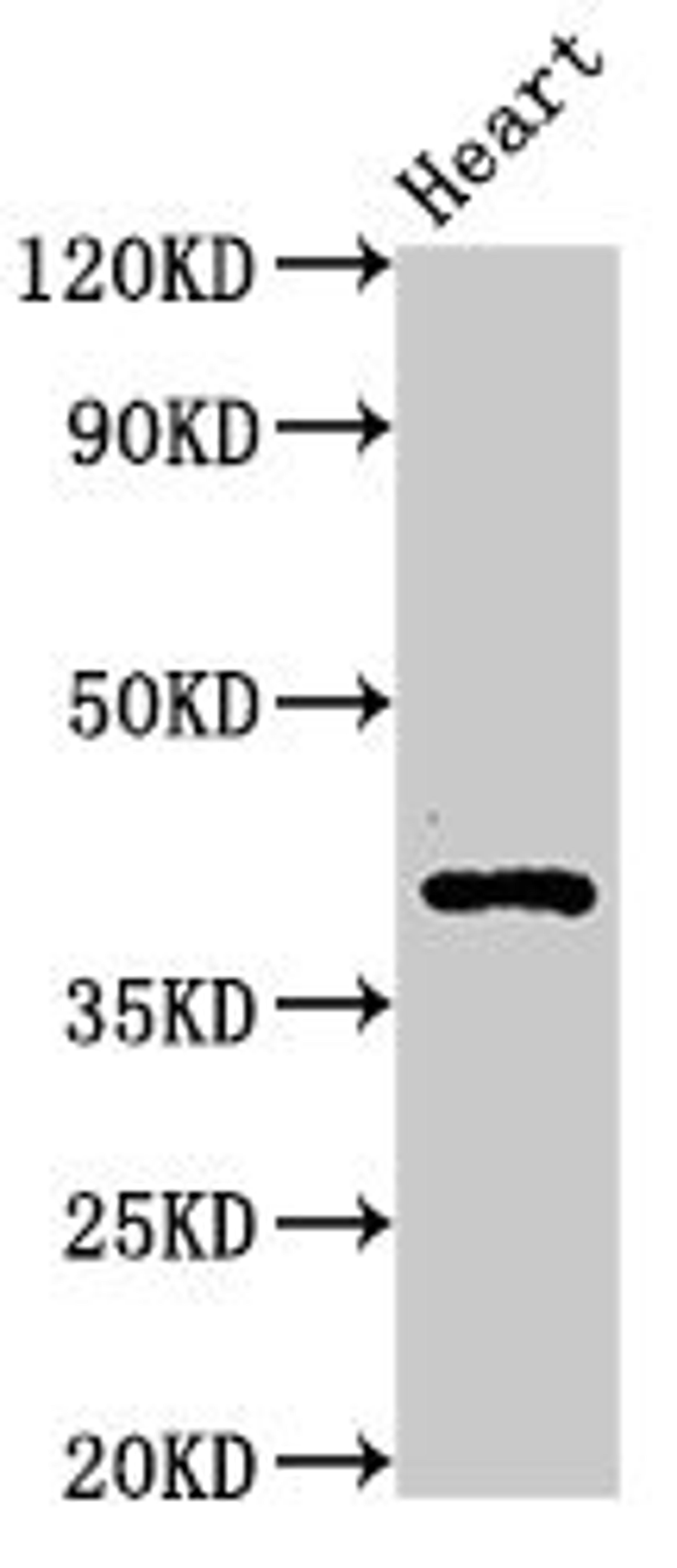 Western Blot. Positive WB detected in: Rat heart tissue. All lanes: MECR antibody at 3.3ug/ml. Secondary. Goat polyclonal to rabbit IgG at 1/50000 dilution. Predicted band size: 41, 33 kDa. Observed band size: 41 kDa. 