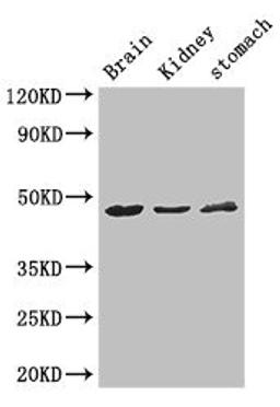 Western Blot. Positive WB detected in: Mouse brain tissue, Mouse kidney tissue, Mouse stomach tissue. All lanes: AGK antibody at 3ug/ml. Secondary. Goat polyclonal to rabbit IgG at 1/50000 dilution. Predicted band size: 48, 8 kDa. Observed band size: 48 kDa. 
