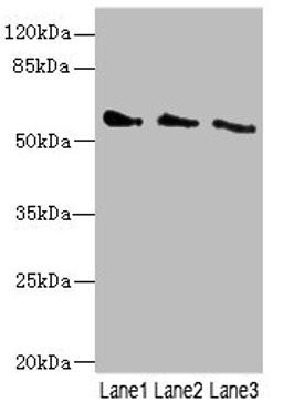 Western blot. All lanes: CHRNG antibody at 5.5ug/ml. Lane 1: 293T whole cell lysate. Lane 2: HepG2 whole cell lysate. Lane 3: Hela whole cell lysate. Secondary. Goat polyclonal to rabbit IgG at 1/10000 dilution. Predicted band size: 58, 53 kDa. Observed band size: 58 kDa. 