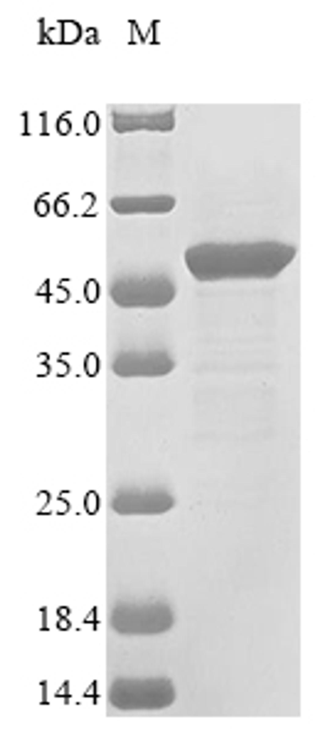 (Tris-Glycine gel) Discontinuous SDS-PAGE (reduced) with 5% enrichment gel and 15% separation gel.