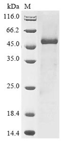 (Tris-Glycine gel) Discontinuous SDS-PAGE (reduced) with 5% enrichment gel and 15% separation gel.