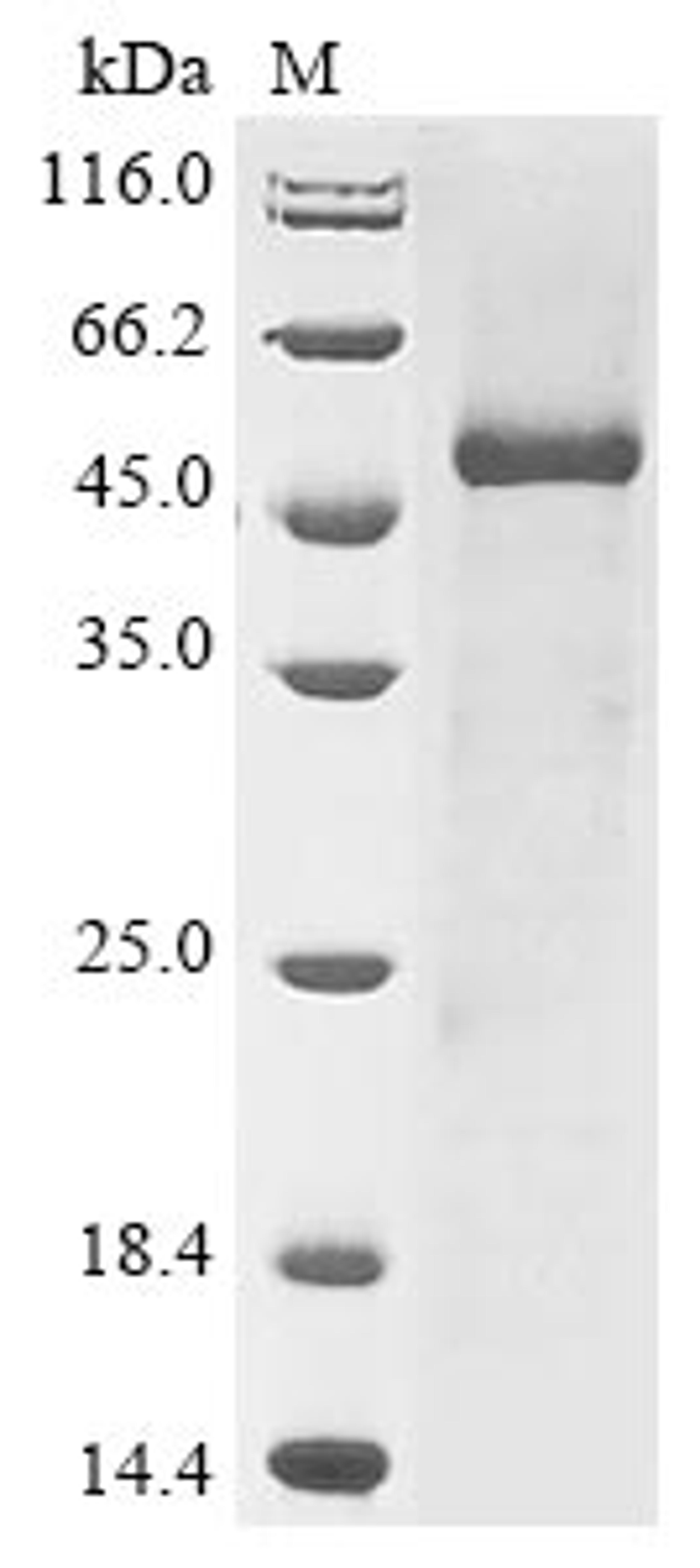 (Tris-Glycine gel) Discontinuous SDS-PAGE (reduced) with 5% enrichment gel and 15% separation gel.