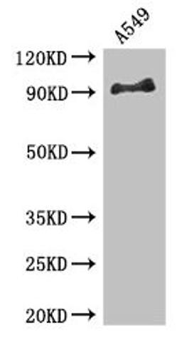 Western Blot. Positive WB detected in: A549 whole cell lysate. All lanes: FGFR1 antibody at 3.4µg/ml. Secondary. Goat polyclonal to rabbit IgG at 1/50000 dilution. Predicted band size: 92, 74, 7, 83, 64, 82, 75, 56, 17, 34, 91, 96 kDa. Observed band size: 92 kDa