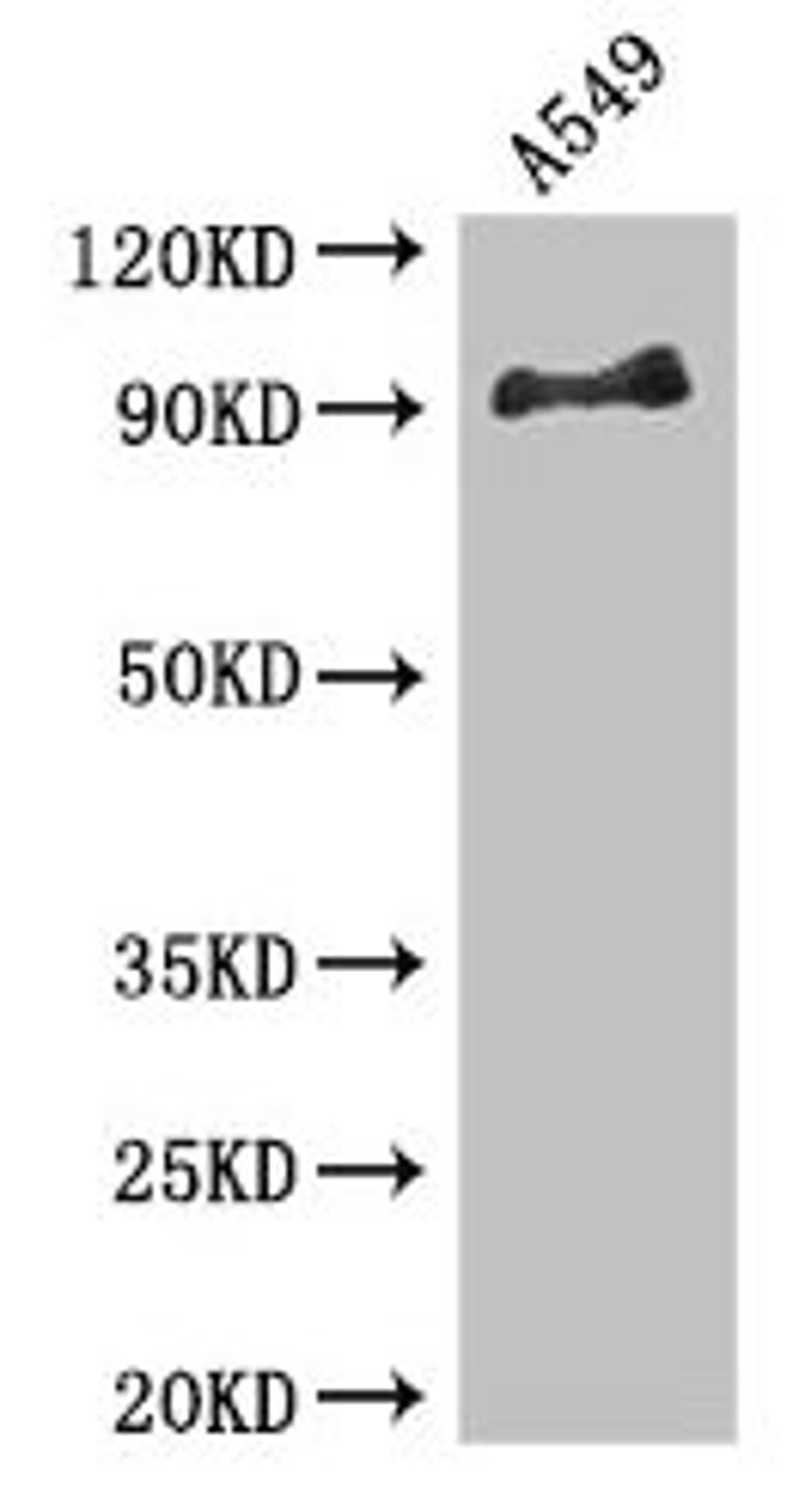 Western Blot. Positive WB detected in: A549 whole cell lysate. All lanes: FGFR1 antibody at 3.4µg/ml. Secondary. Goat polyclonal to rabbit IgG at 1/50000 dilution. Predicted band size: 92, 74, 7, 83, 64, 82, 75, 56, 17, 34, 91, 96 kDa. Observed band size: 92 kDa
