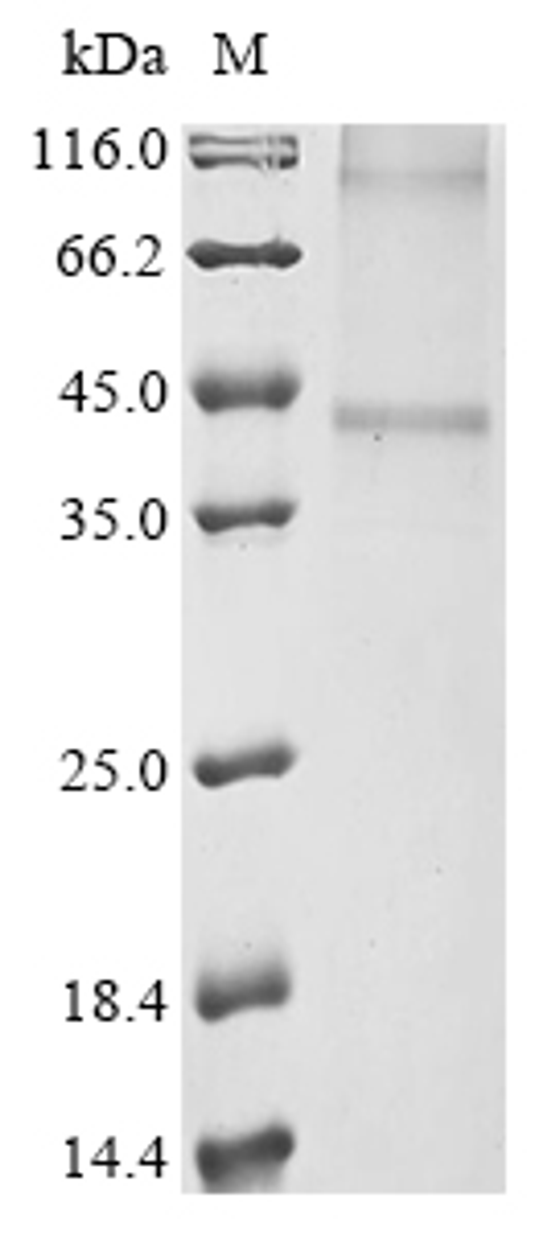 (Tris-Glycine gel) Discontinuous SDS-PAGE (reduced) with 5% enrichment gel and 15% separation gel.