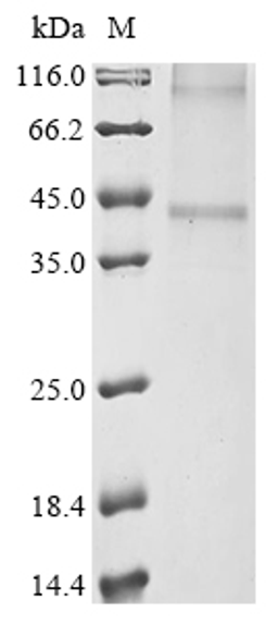 (Tris-Glycine gel) Discontinuous SDS-PAGE (reduced) with 5% enrichment gel and 15% separation gel.