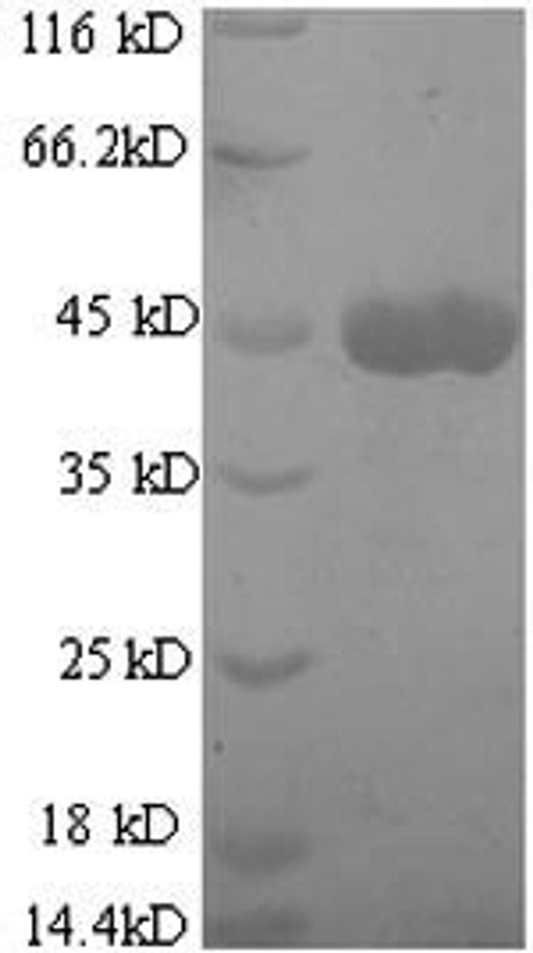 (Tris-Glycine gel) Discontinuous SDS-PAGE (reduced) with 5% enrichment gel and 15% separation gel.