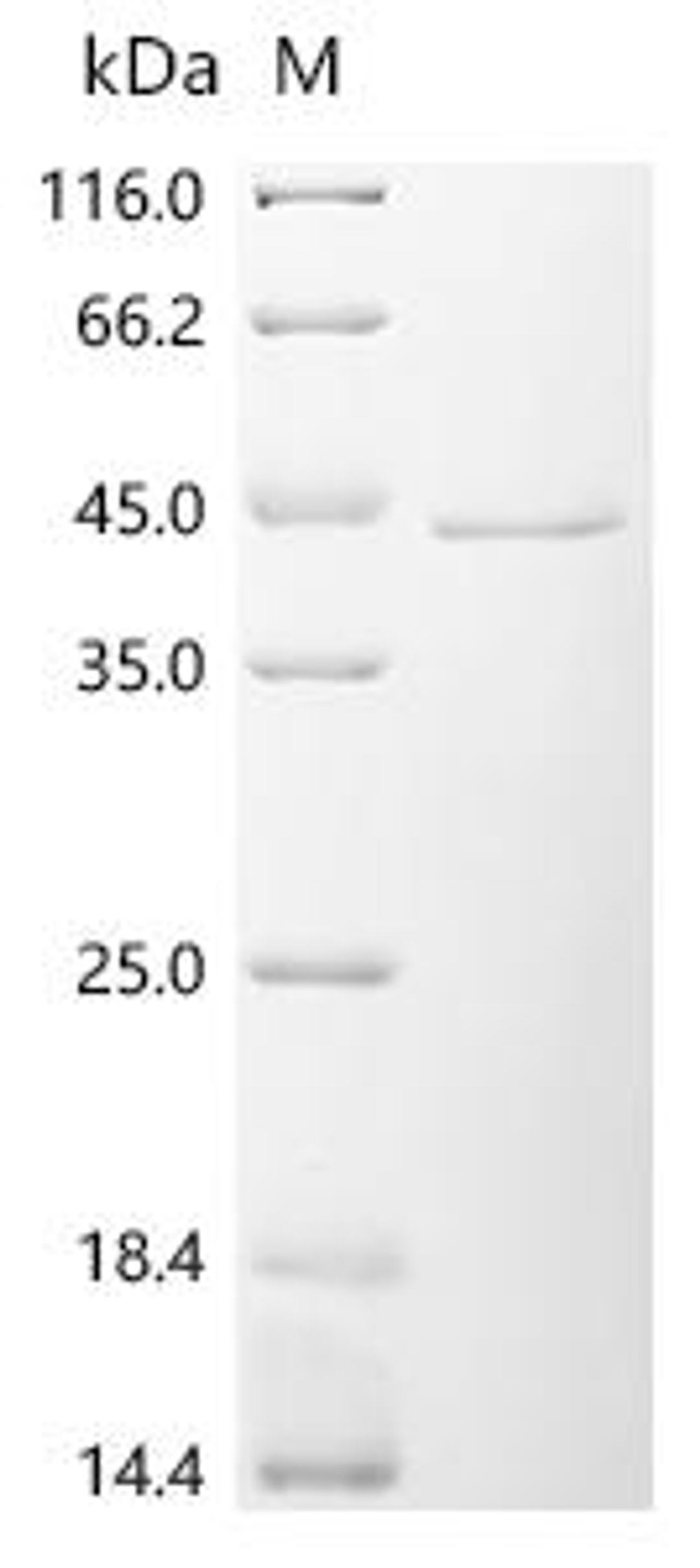 (Tris-Glycine gel) Discontinuous SDS-PAGE (reduced) with 5% enrichment gel and 15% separation gel.