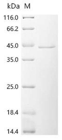 (Tris-Glycine gel) Discontinuous SDS-PAGE (reduced) with 5% enrichment gel and 15% separation gel.