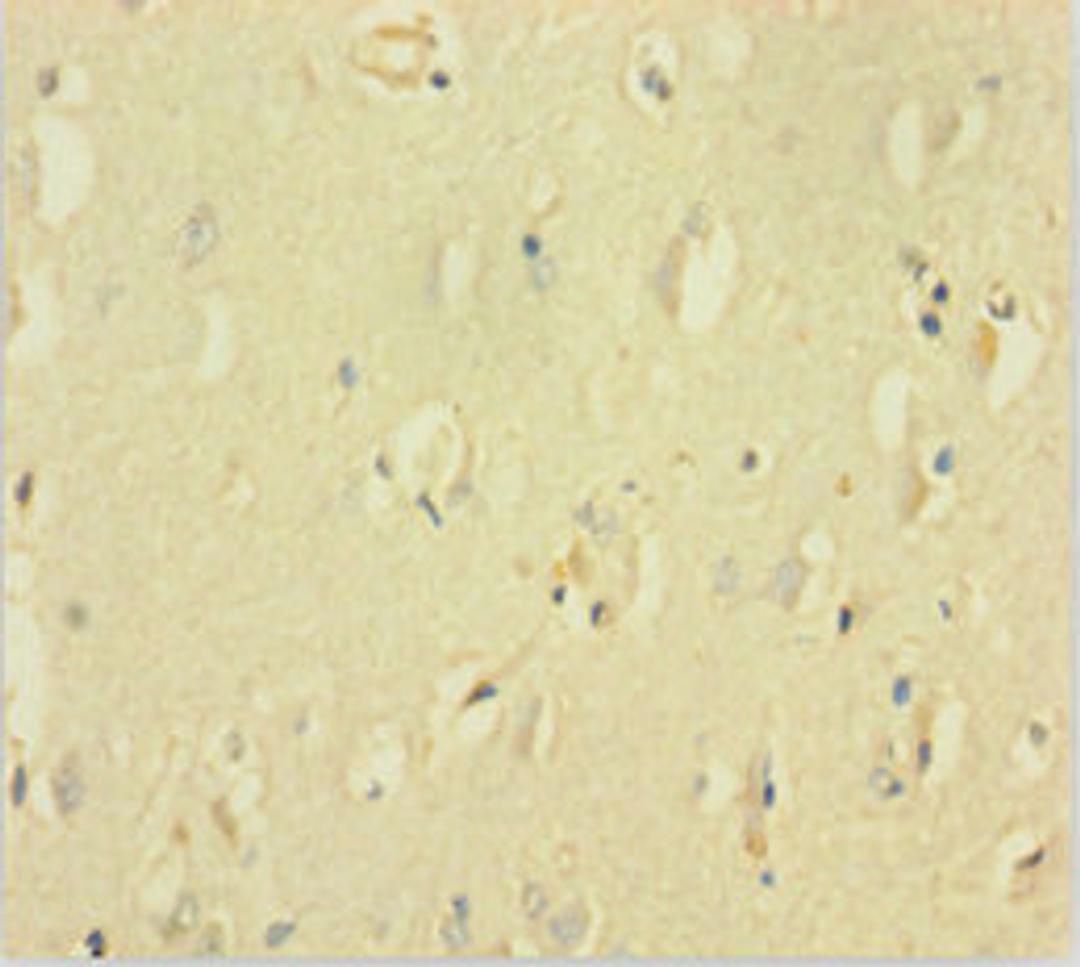 Immunohistochemistry of paraffin-embedded human brain tissue using CSB-PA891564LA01HU at dilution of 1:100