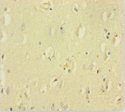 Immunohistochemistry of paraffin-embedded human brain tissue using CSB-PA891564LA01HU at dilution of 1:100