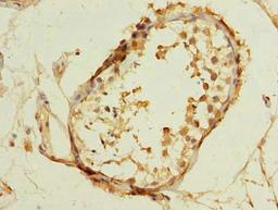 Immunohistochemistry of paraffin-embedded human testis tissue using CSB-PA023624LA01HU at dilution of 1:100