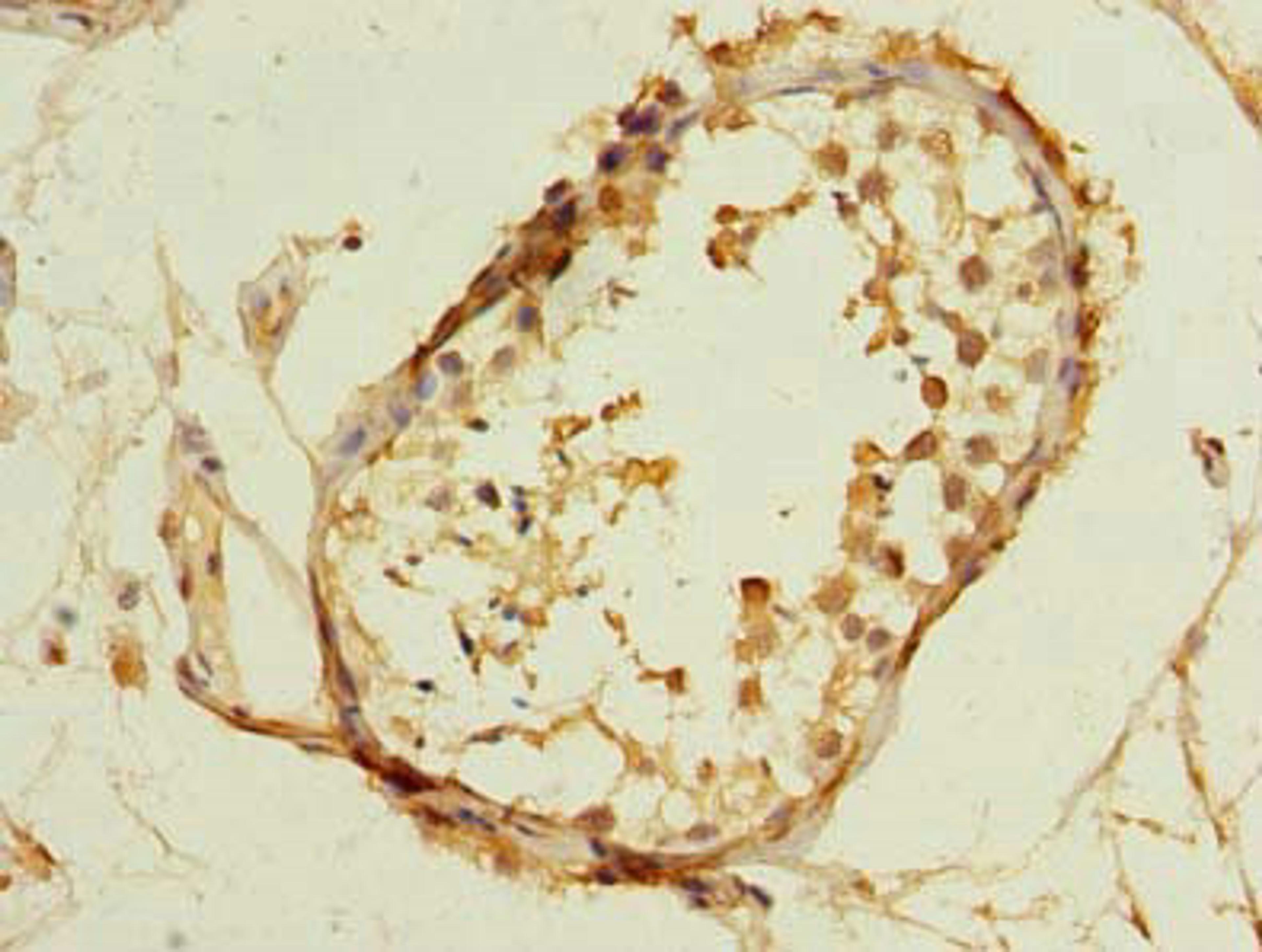 Immunohistochemistry of paraffin-embedded human testis tissue using CSB-PA023624LA01HU at dilution of 1:100