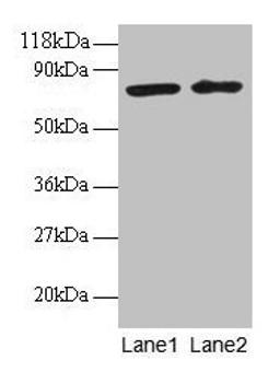 Western blot. All lanes: BLOC1S1 antibody at 2µg/ml. Lane 1: EC109 whole cell lysate. Lane 2: 293T whole cell lysate. Secondary. Goat polyclonal to rabbit IgG at 1/15000 dilution. Predicted band size: 18, 15 kDa. Observed band size: 75 kDa