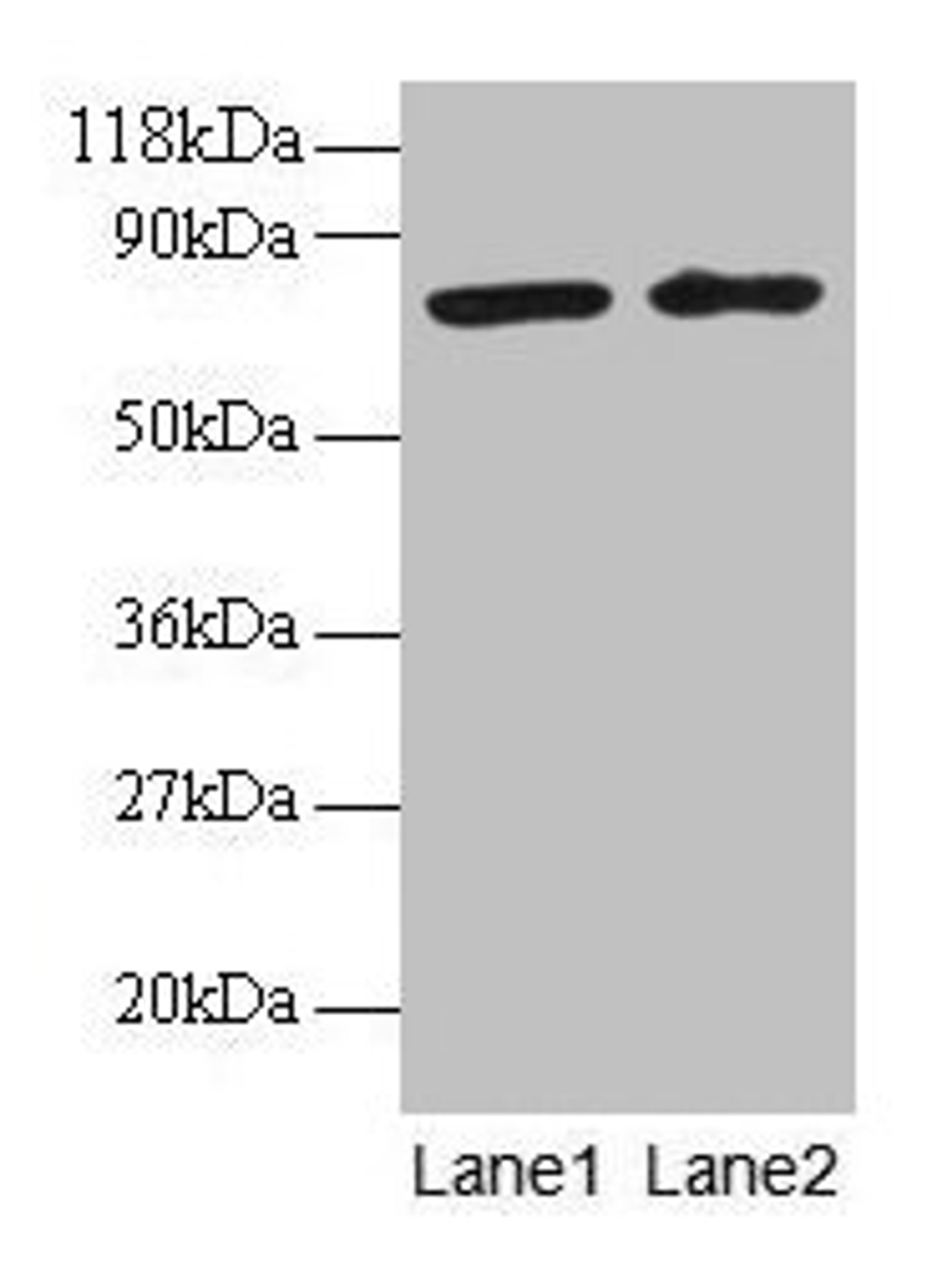 Western blot. All lanes: BLOC1S1 antibody at 2µg/ml. Lane 1: EC109 whole cell lysate. Lane 2: 293T whole cell lysate. Secondary. Goat polyclonal to rabbit IgG at 1/15000 dilution. Predicted band size: 18, 15 kDa. Observed band size: 75 kDa