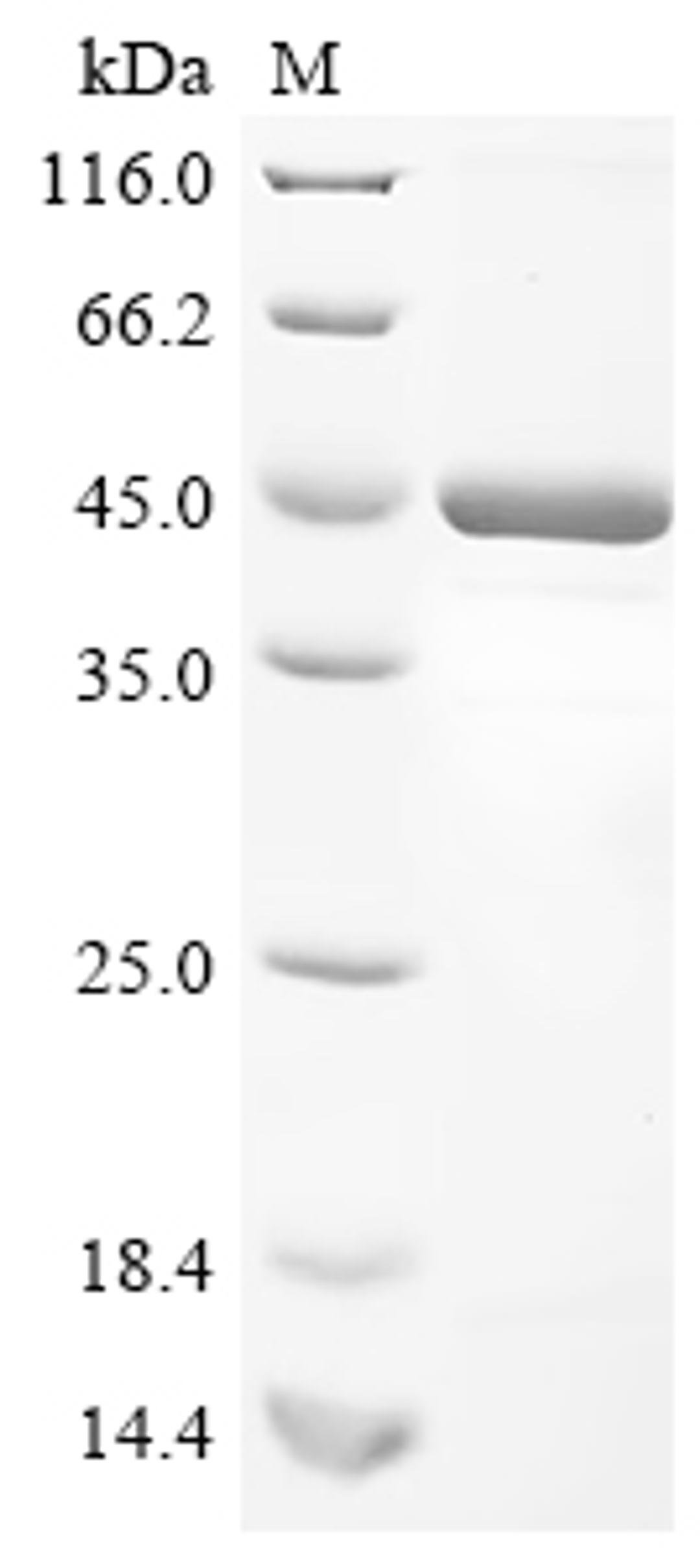 (Tris-Glycine gel) Discontinuous SDS-PAGE (reduced) with 5% enrichment gel and 15% separation gel.