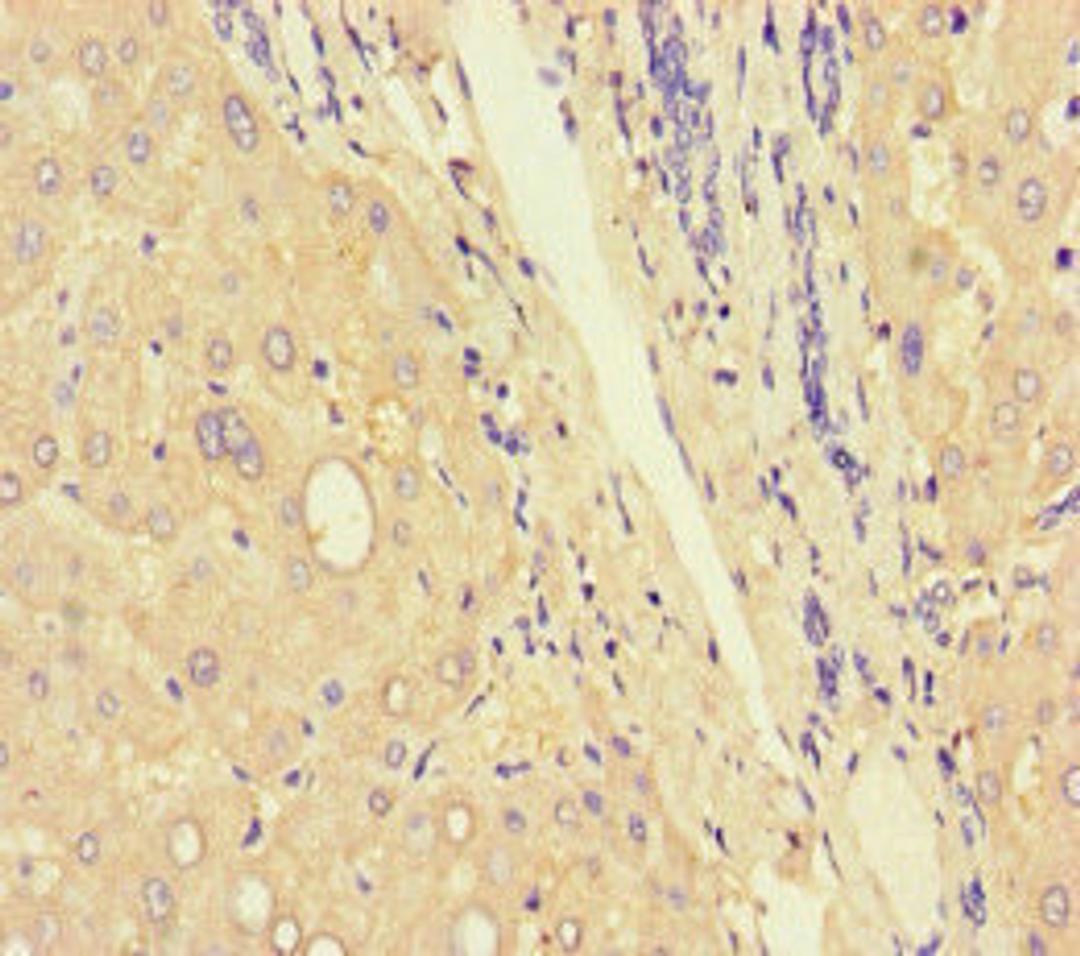 Immunohistochemistry of paraffin-embedded human liver tissue using CSB-PA004259LA01HU at dilution of 1:100