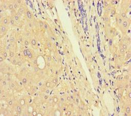 Immunohistochemistry of paraffin-embedded human liver tissue using CSB-PA004259LA01HU at dilution of 1:100