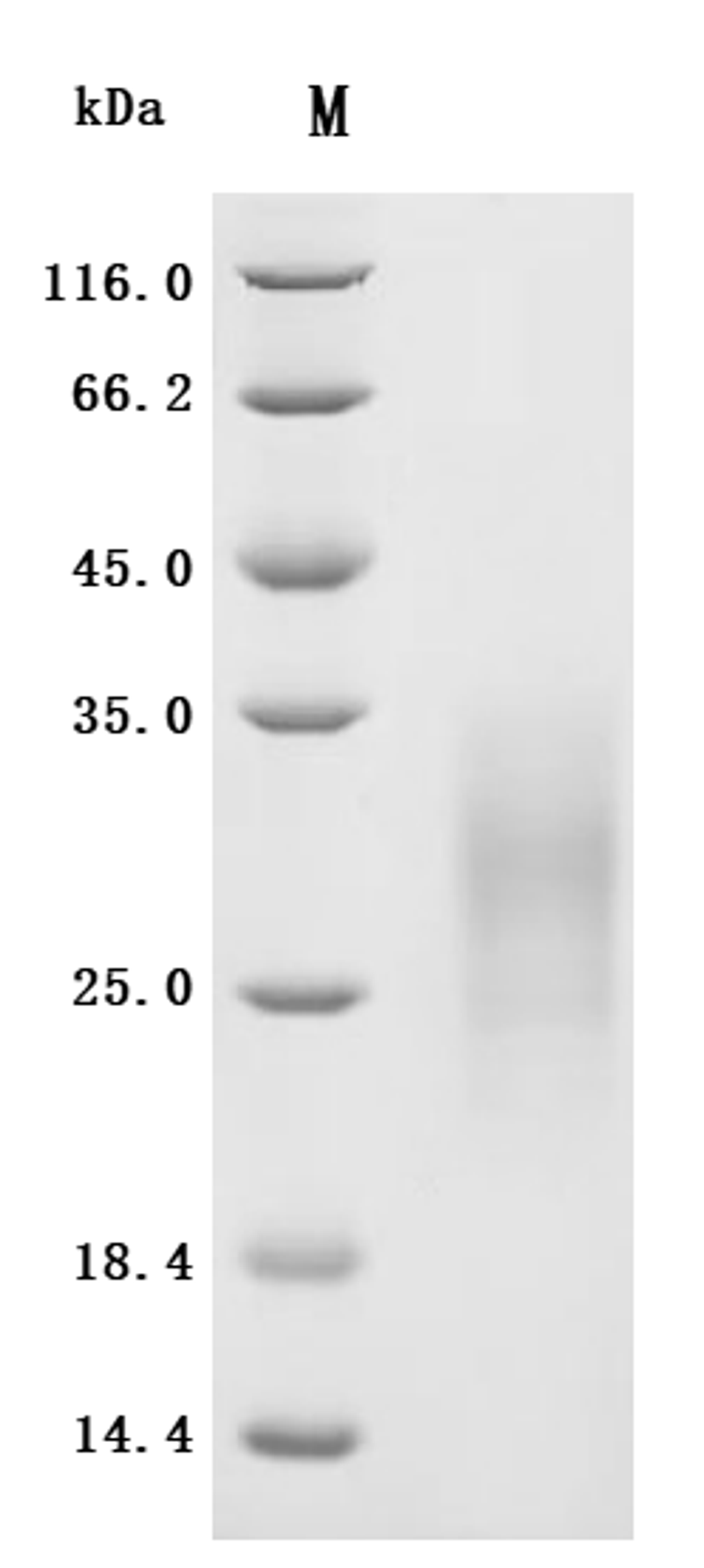 (Tris-Glycine gel) Discontinuous SDS-PAGE (reduced) with 5% enrichment gel and 15% separation gel.