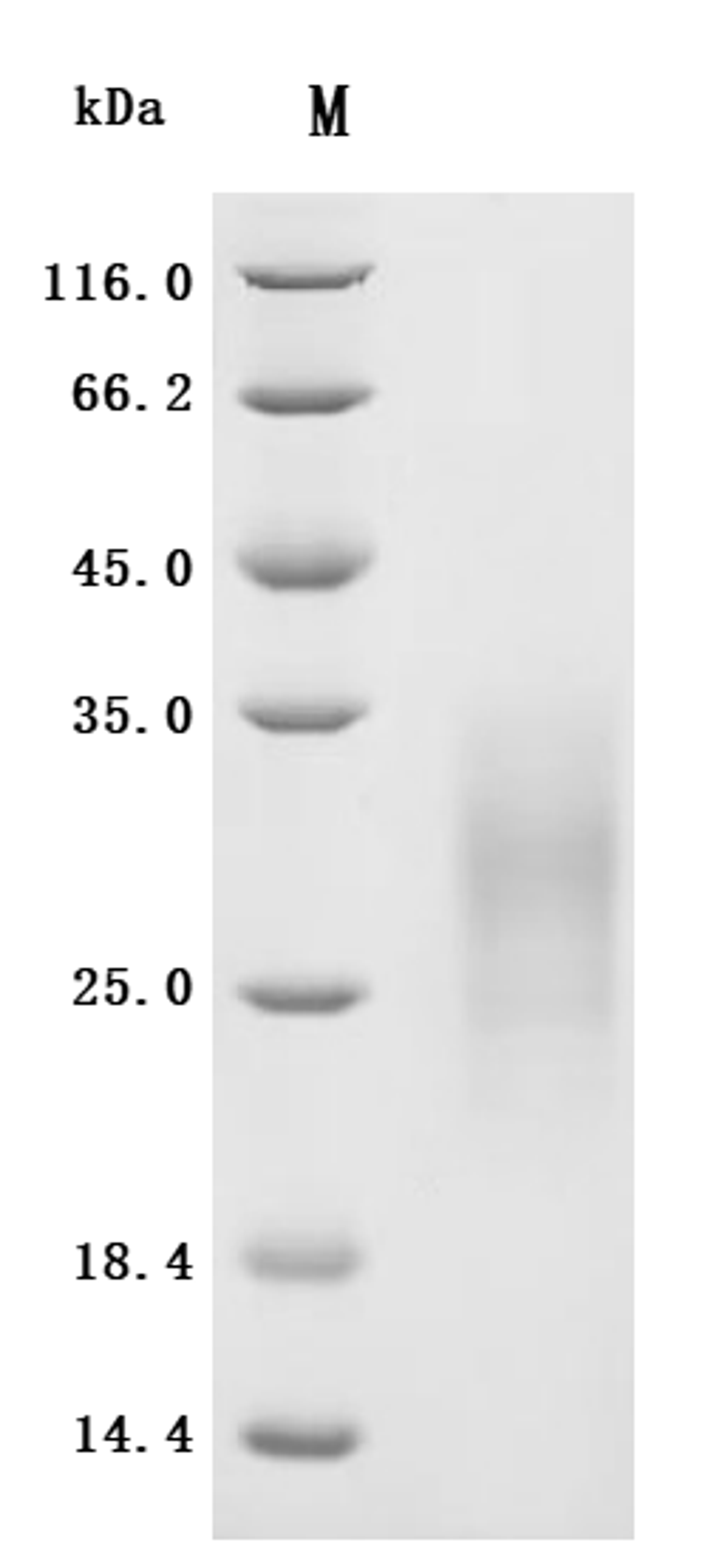 (Tris-Glycine gel) Discontinuous SDS-PAGE (reduced) with 5% enrichment gel and 15% separation gel.