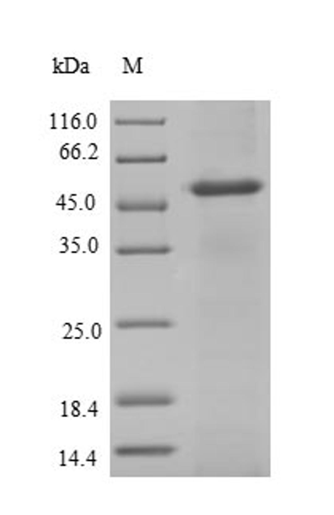 (Tris-Glycine gel) Discontinuous SDS-PAGE (reduced) with 5% enrichment gel and 15% separation gel.