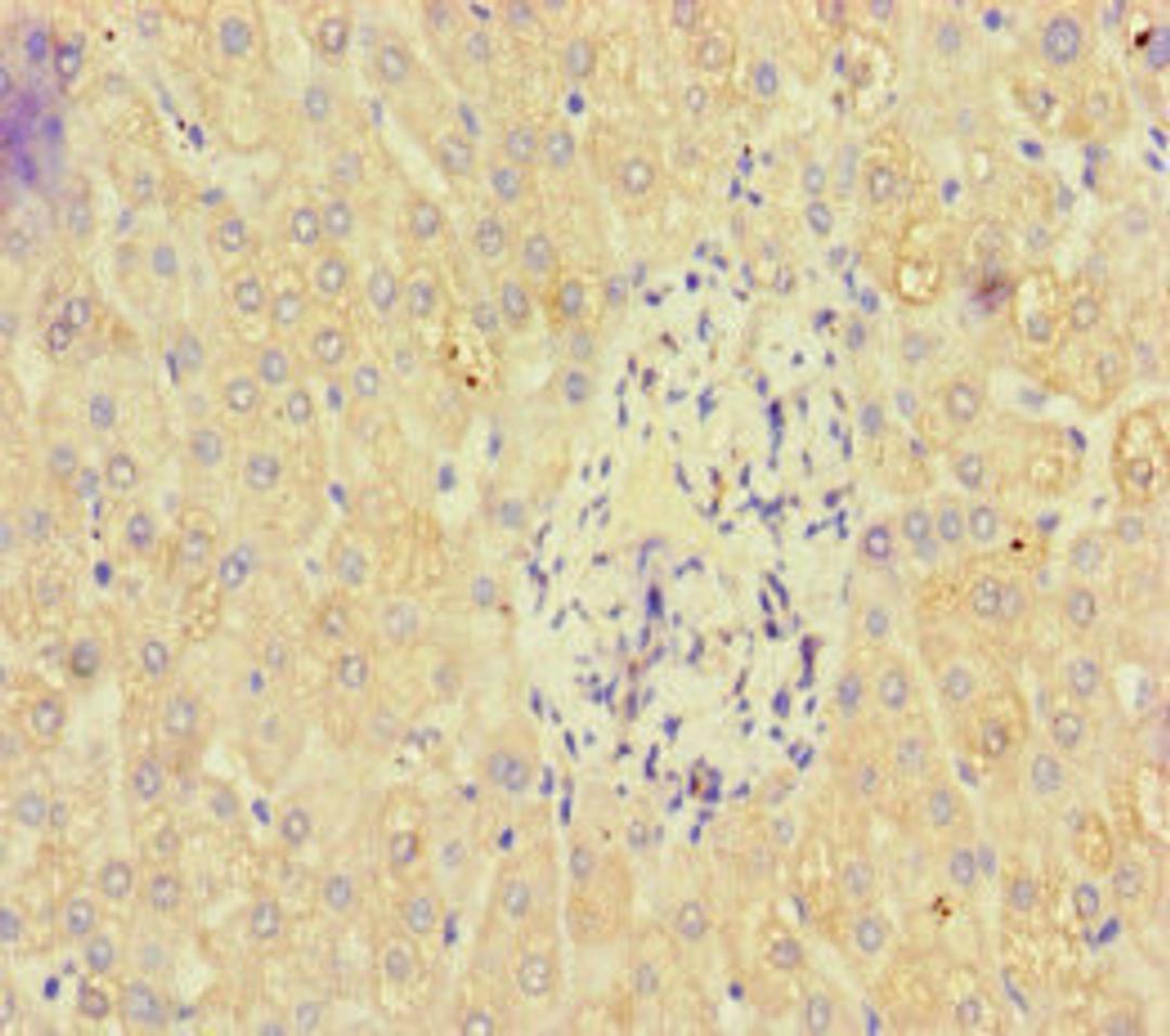 Immunohistochemistry of paraffin-embedded human liver tissue using CSB-PA681391LA01HU at dilution of 1:100