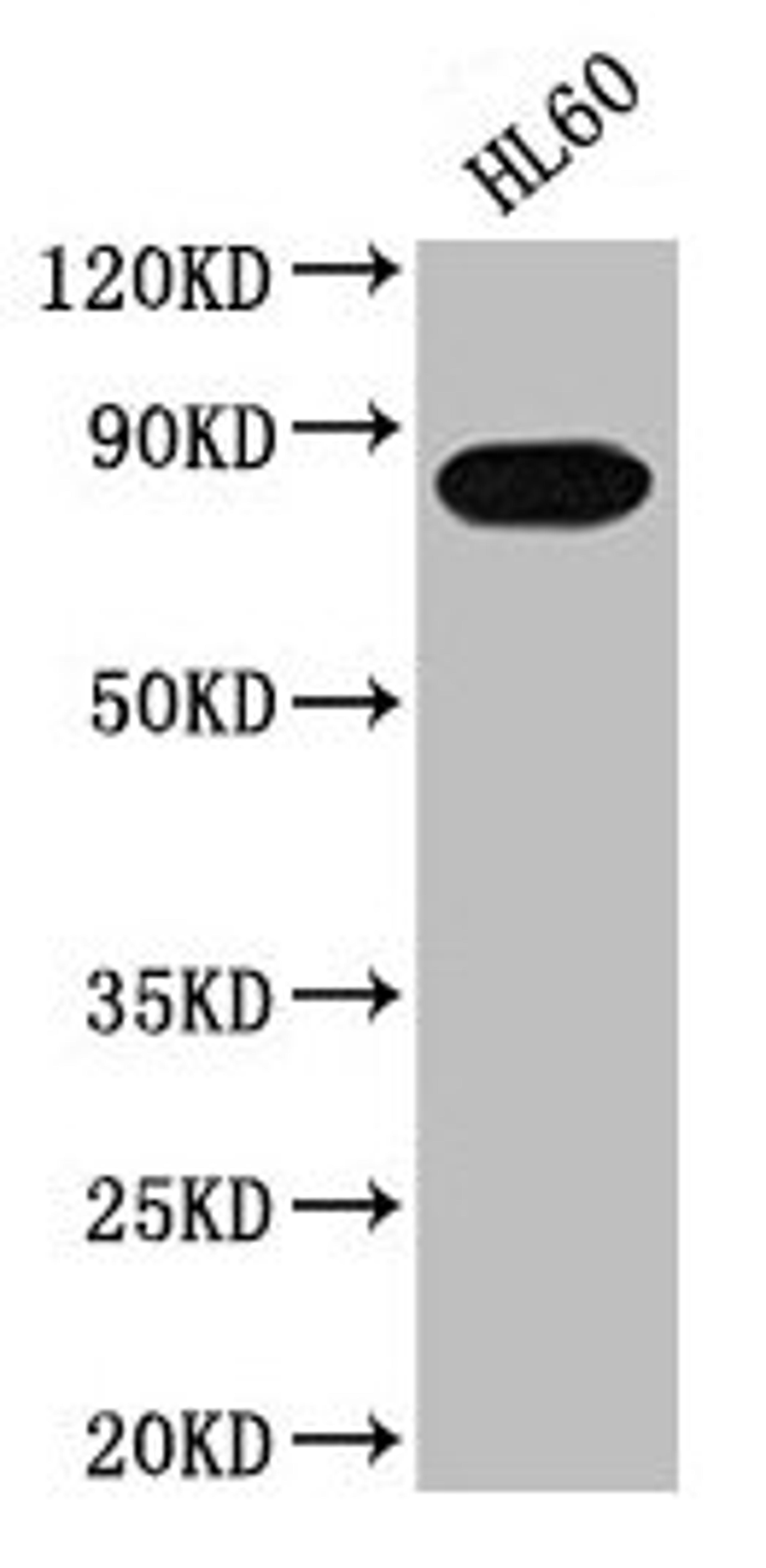 Western Blot. Positive WB detected in: HL60 whole cell lysate. All lanes: PREP antibody at 1:2000. Secondary. Goat polyclonal to rabbit IgG at 1/50000 dilution. Predicted band size: 81 kDa. Observed band size: 81 kDa