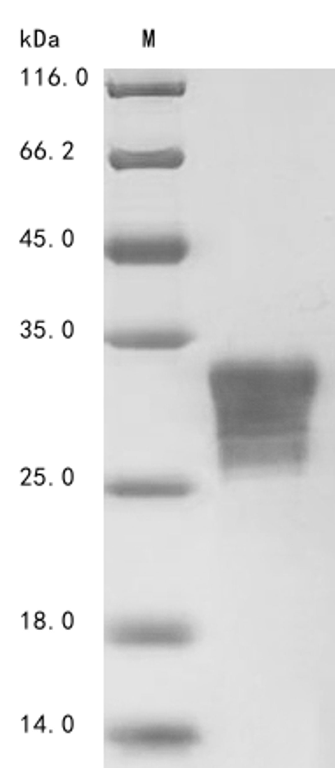 (Tris-Glycine gel) Discontinuous SDS-PAGE (reduced) with 5% enrichment gel and 15% separation gel.