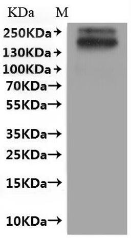 CSB-MP021679HU is detected by Mouse anti-Flag-tagged monoclonal antibody.