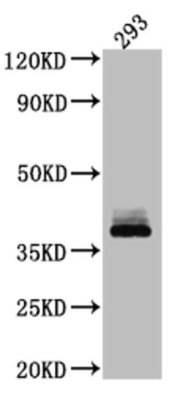 Western Blot. Positive WB detected in: 293 whole cell lysate. All lanes: DKK1 antibody at 1:1000. Secondary. Goat polyclonal to rabbit IgG at 1/50000 dilution. Predicted band size: 29 kDa. Observed band size: 38 kDa. 