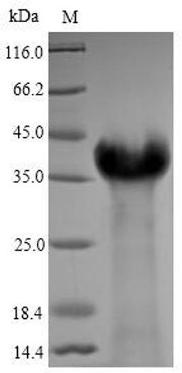 (Tris-Glycine gel) Discontinuous SDS-PAGE (reduced) with 5% enrichment gel and 15% separation gel.
