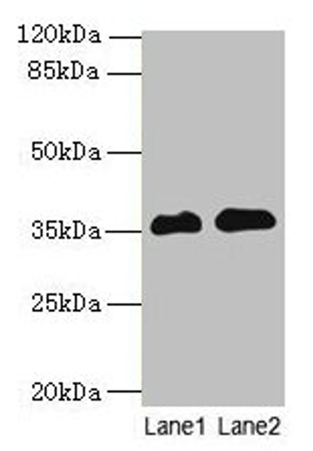 Western blot. All lanes: RFPL3 antibody at 8µg/ml. Lane 1: Human placenta tissue. Lane 2: HL60 whole cell lysate. Secondary. Goat polyclonal to rabbit IgG at 1/10000 dilution. Predicted band size: 36, 33 kDa. Observed band size: 36 kDa