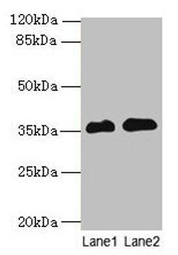 Western blot. All lanes: RFPL3 antibody at 8µg/ml. Lane 1: Human placenta tissue. Lane 2: HL60 whole cell lysate. Secondary. Goat polyclonal to rabbit IgG at 1/10000 dilution. Predicted band size: 36, 33 kDa. Observed band size: 36 kDa