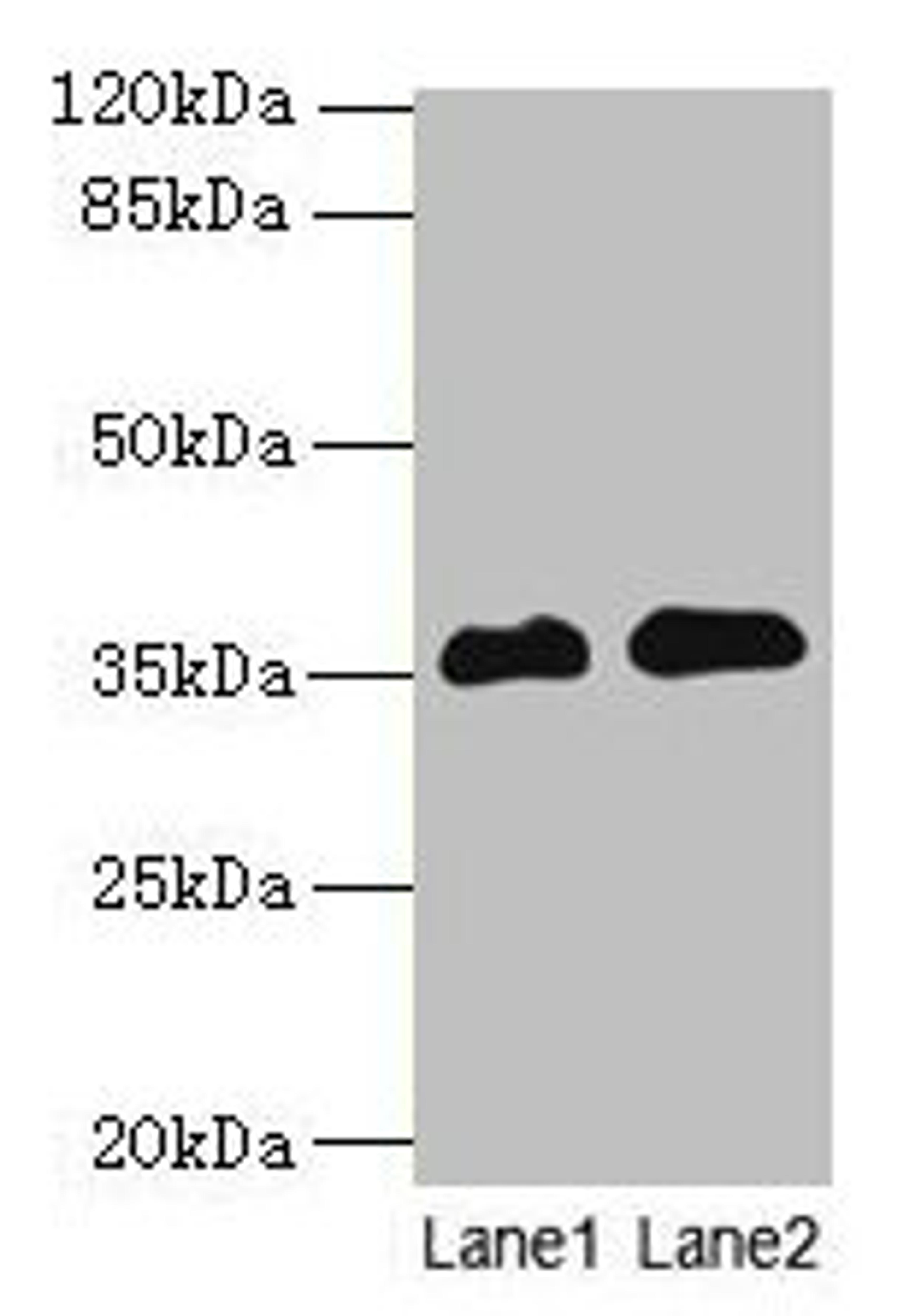 Western blot. All lanes: RFPL3 antibody at 8µg/ml. Lane 1: Human placenta tissue. Lane 2: HL60 whole cell lysate. Secondary. Goat polyclonal to rabbit IgG at 1/10000 dilution. Predicted band size: 36, 33 kDa. Observed band size: 36 kDa