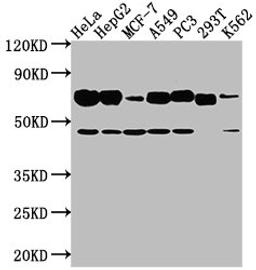 Western Blot. Positive WB detected in: Hela whole cell lysate, HepG2 whole cell lysate, MCF-7 whole cell lysate, A549 whole cell lysate, PC3 whole cell lysate, 293T whole cell lysate, K562 whole cell lysate. All lanes: SLC3A2 antibody at 1:2000. Secondary. Goat polyclonal to rabbit IgG at 1/50000 dilution. Predicted band size: 68, 58, 62, 72 kDa. Observed band size: 68 kDa. 