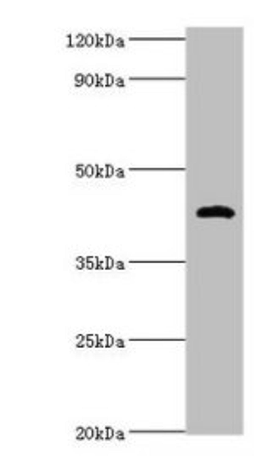 Western blot. All lanes: HP antibody at 2µg/ml + Mouse stomach tissue. Secondary. Goat polyclonal to rabbit IgG at 1/10000 dilution. Predicted band size: 46, 39 kDa. Observed band size: 46 kDa