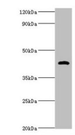 Western blot. All lanes: HP antibody at 2µg/ml + Mouse stomach tissue. Secondary. Goat polyclonal to rabbit IgG at 1/10000 dilution. Predicted band size: 46, 39 kDa. Observed band size: 46 kDa