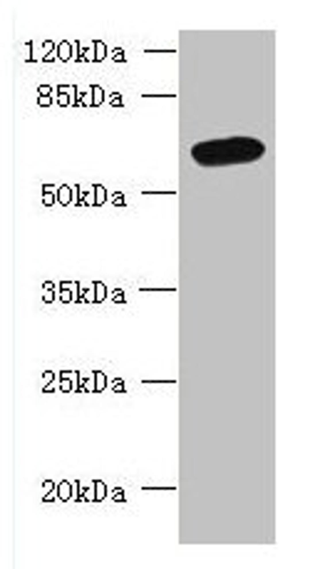 Western blot. All lanes: FAM149B1 antibody at 3µg/ml + Mouse liver tissue. Secondary. Goat polyclonal to rabbit IgG at 1/10000 dilution. Predicted band size: 65, 59 kDa. Observed band size: 65 kDa