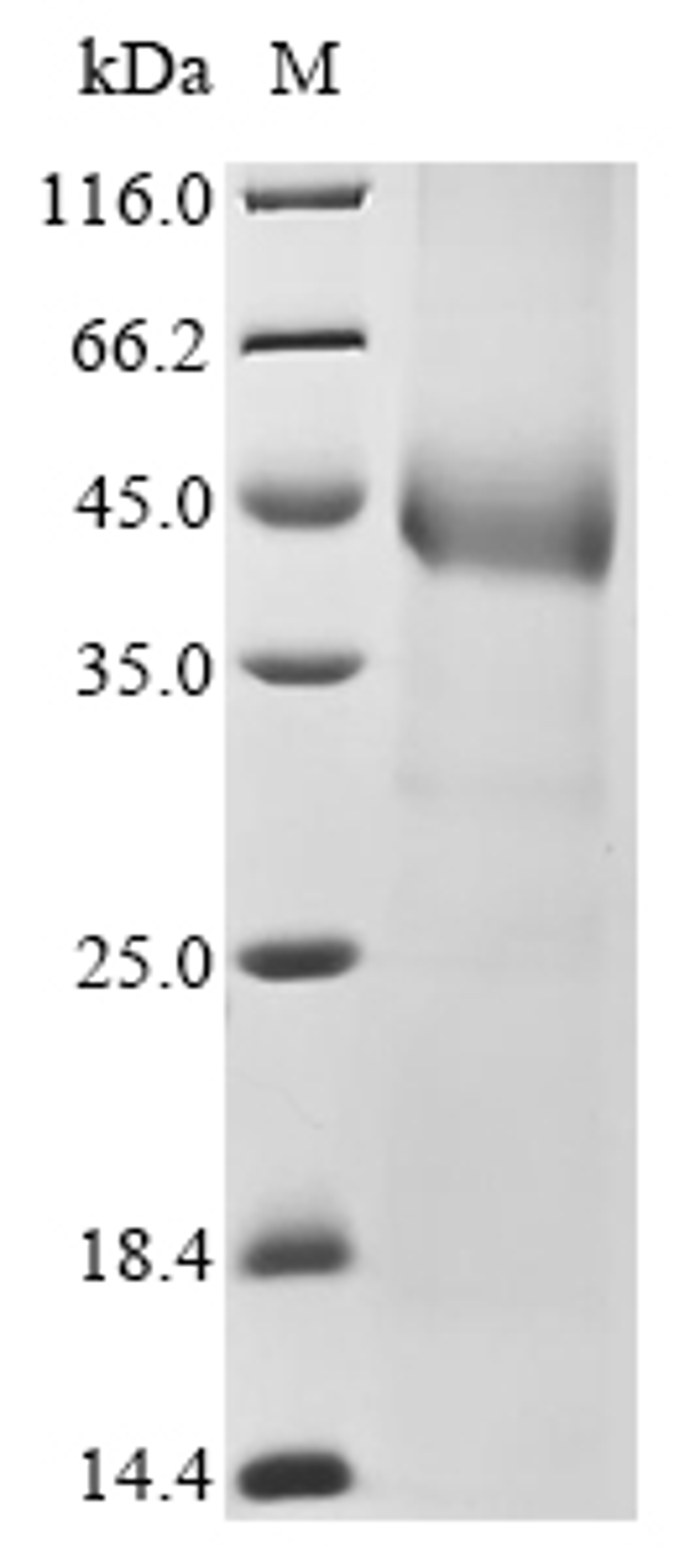 (Tris-Glycine gel) Discontinuous SDS-PAGE (reduced) with 5% enrichment gel and 15% separation gel.