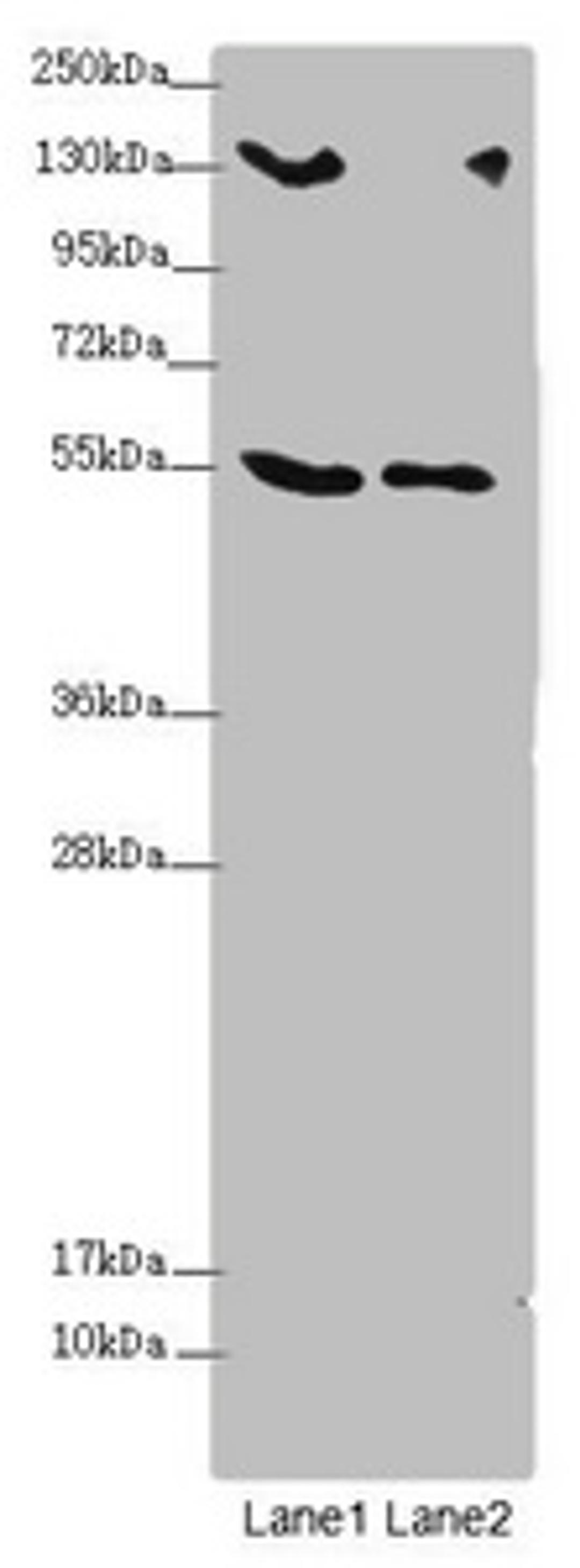 Western blot. All lanes: CSPP1 antibody at 1.53 ug/ml. Lane 1: 293T whole cell lysate. Lane 2: Jurkat whole cell lysate. Secondary. Goat polyclonal to rabbit IgG at 1/10000 dilution. Predicted band size: 146, 142, 102 kDa. Observed band size: 146, 75, 55 kDa. 