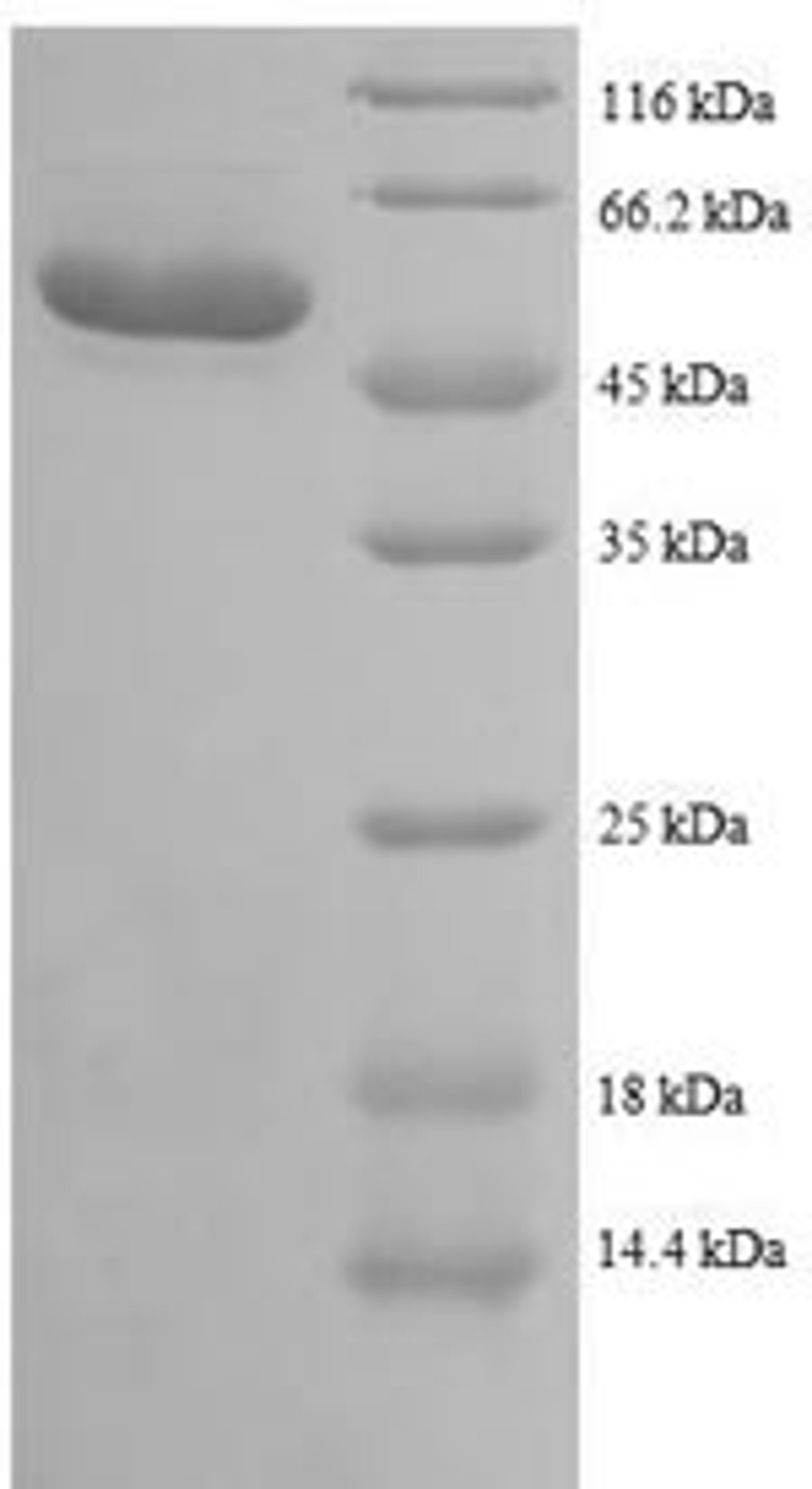(Tris-Glycine gel) Discontinuous SDS-PAGE (reduced) with 5% enrichment gel and 15% separation gel.