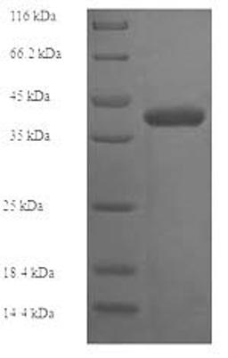 (Tris-Glycine gel) Discontinuous SDS-PAGE (reduced) with 5% enrichment gel and 15% separation gel.