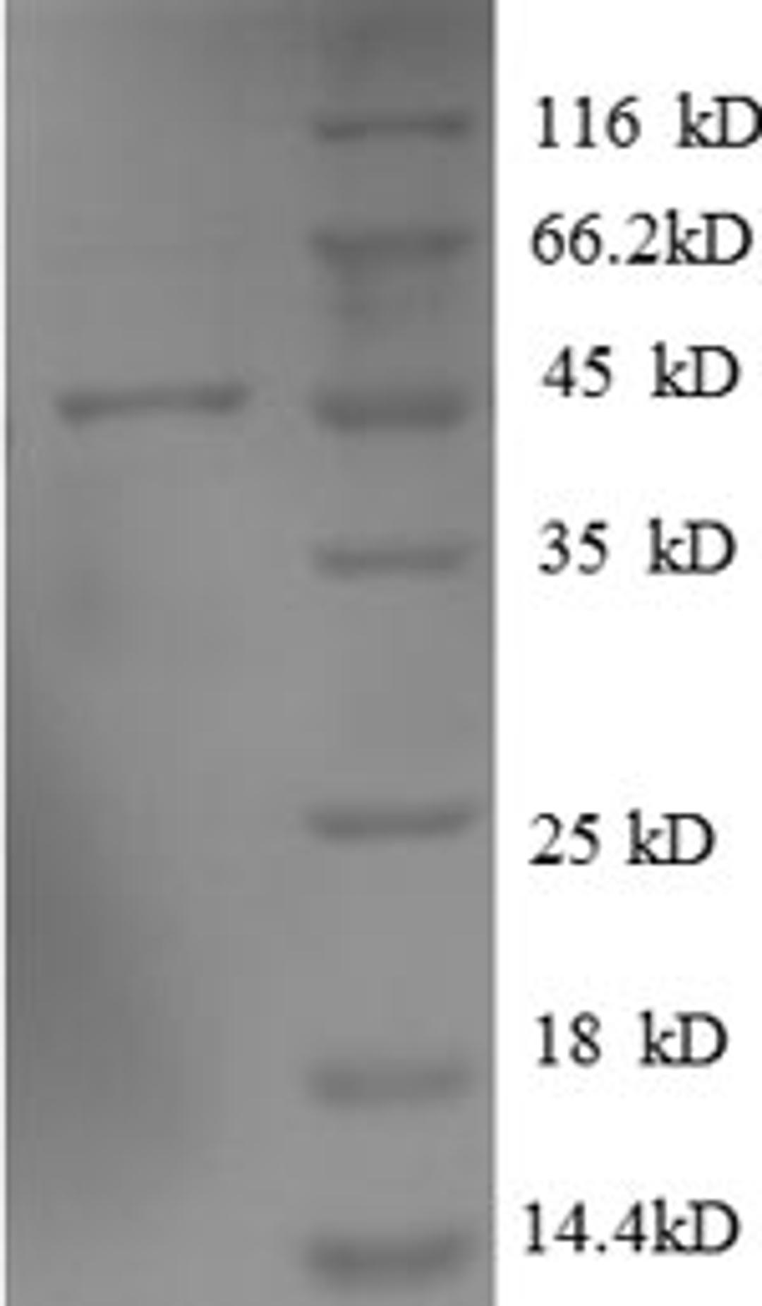 (Tris-Glycine gel) Discontinuous SDS-PAGE (reduced) with 5% enrichment gel and 15% separation gel.