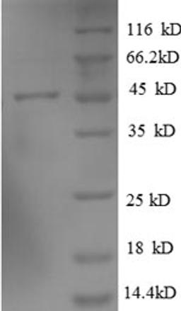 (Tris-Glycine gel) Discontinuous SDS-PAGE (reduced) with 5% enrichment gel and 15% separation gel.
