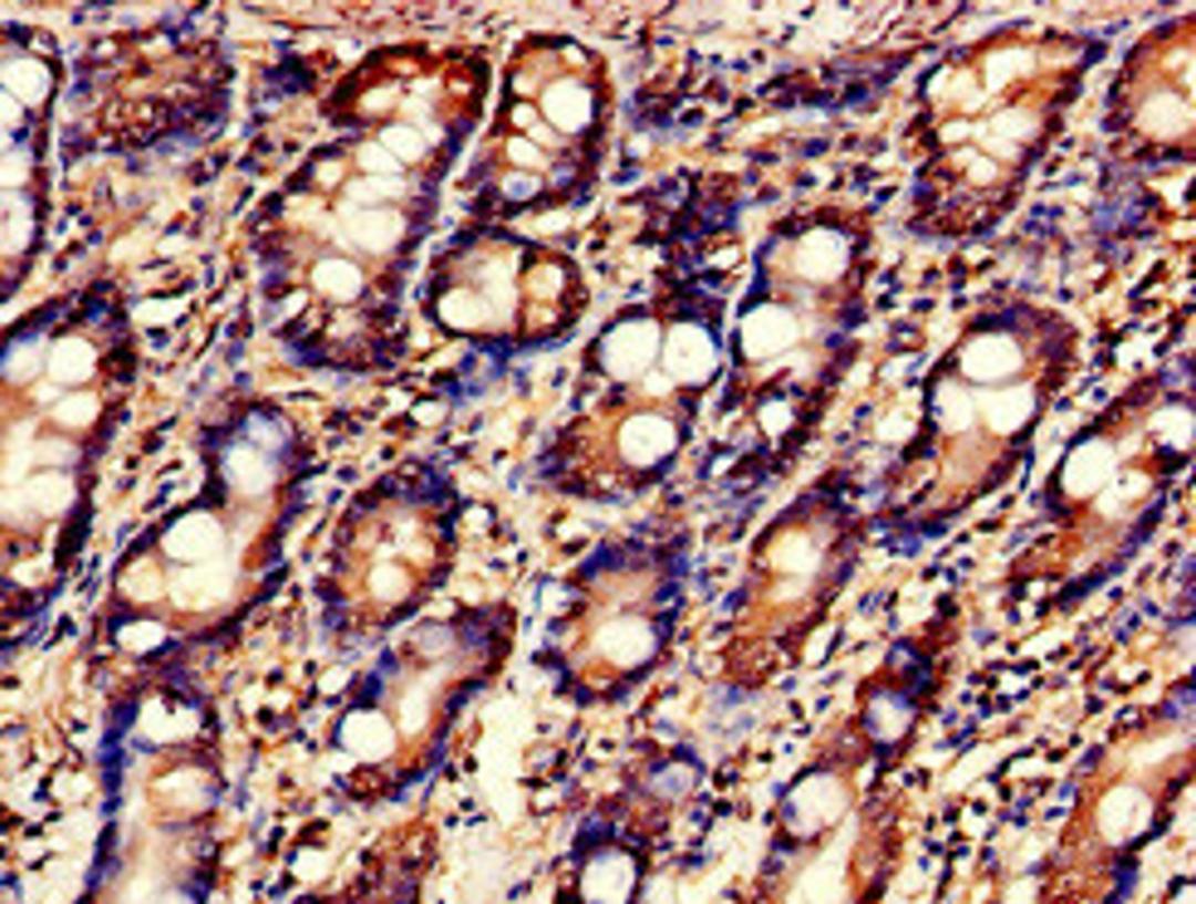 Immunohistochemistry of paraffin-embedded human small intestine tissue using CSB-PA013498LA01HU at dilution of 1:100