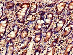Immunohistochemistry of paraffin-embedded human small intestine tissue using CSB-PA013498LA01HU at dilution of 1:100